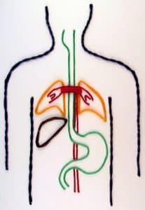 wikki stix